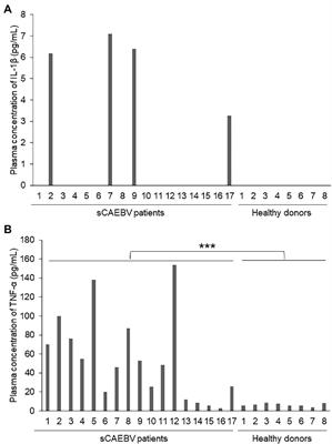 The Plasma Level of Interleukin-1β Can Be a Biomarker of Angiopathy in Systemic Chronic Active Epstein–Barr Virus Infection